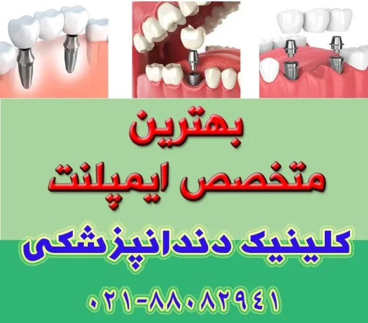 ایمپلنت