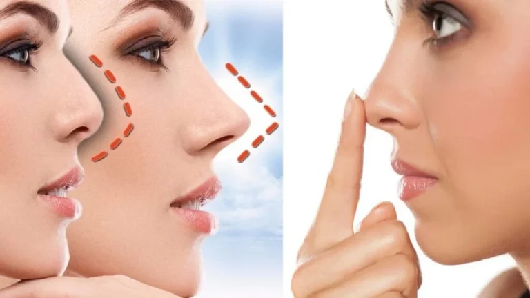 جراحی بینی به چه صورت انجام میشود؟