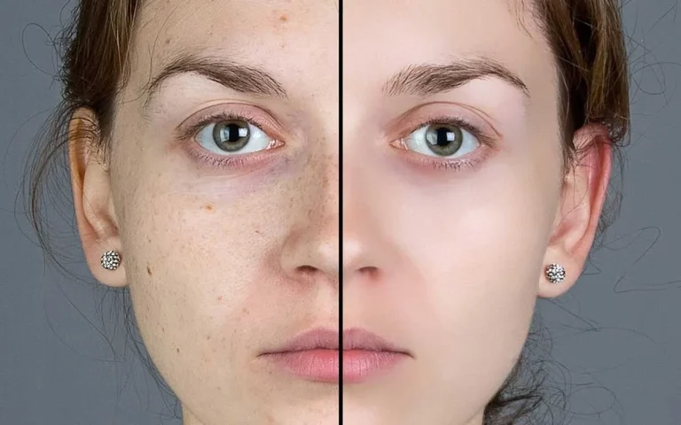 چگونه صورتی صاف و یک دست داشته باشم؟