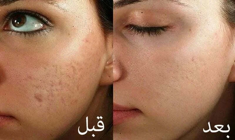 عمومی