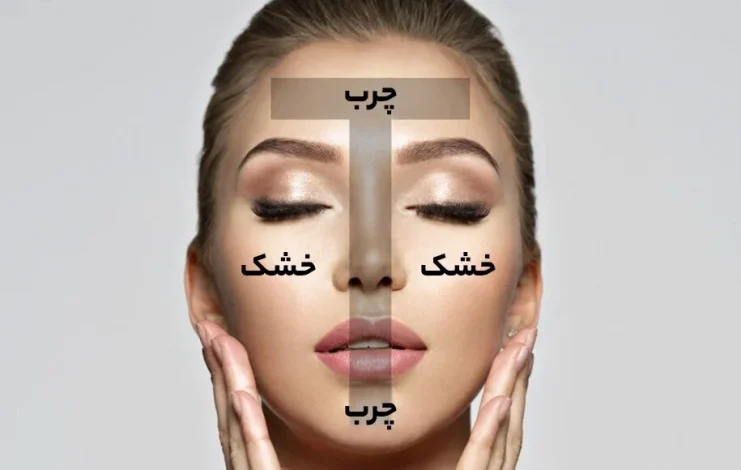 پوست