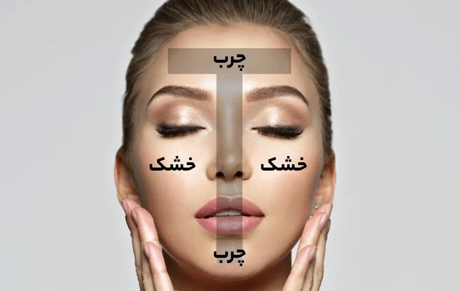 پوست