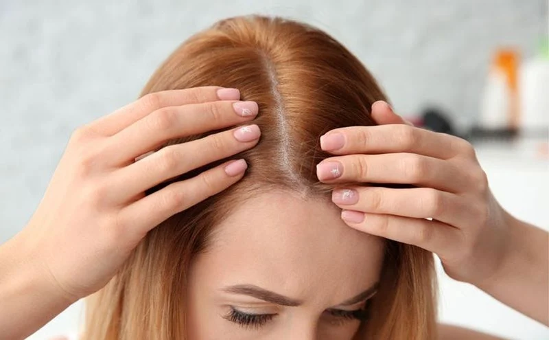 Everything you need to know about minoxidil solution