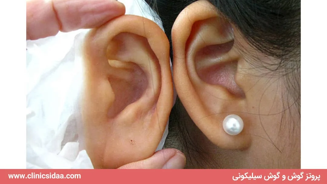 توانبخشی