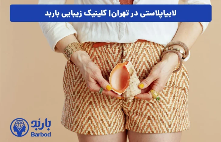 اپل
