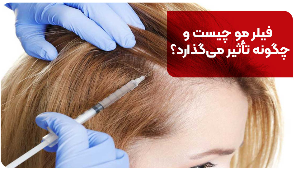 فیلر مو چیست و چگونه تأثیر می‌گذارد؟