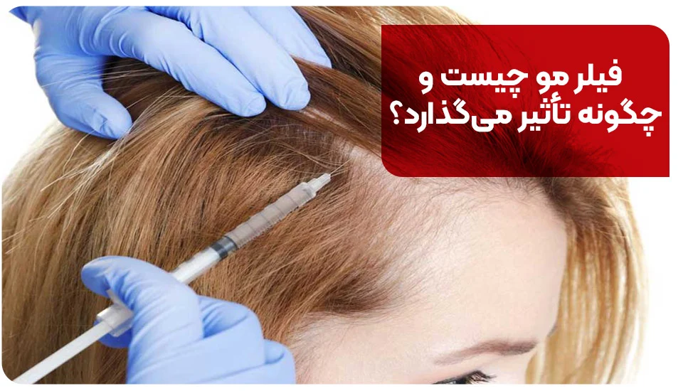 فیلر مو چیست و چگونه تأثیر می&zwnj;گذارد؟
