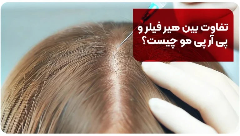 تفاوت بین هیر فیلر و پی آر پی مو چیست؟