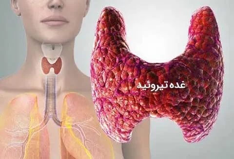 بیماری