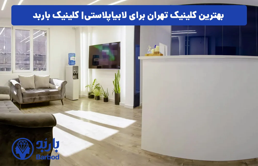 اپل