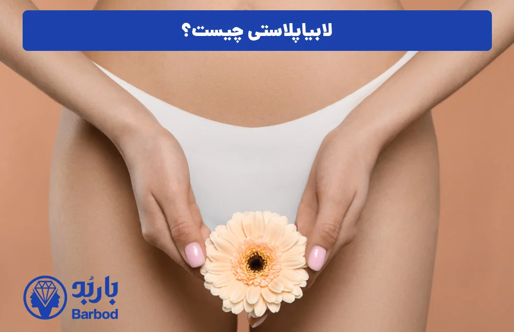 اپل