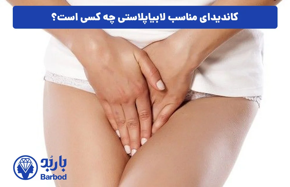 اپل