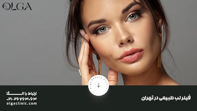 فیلر لب طبیعی در تهران